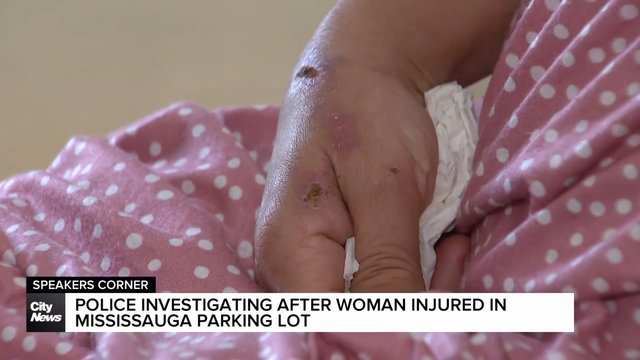 Police investigating after Mississauga woman injured in parking lot incident