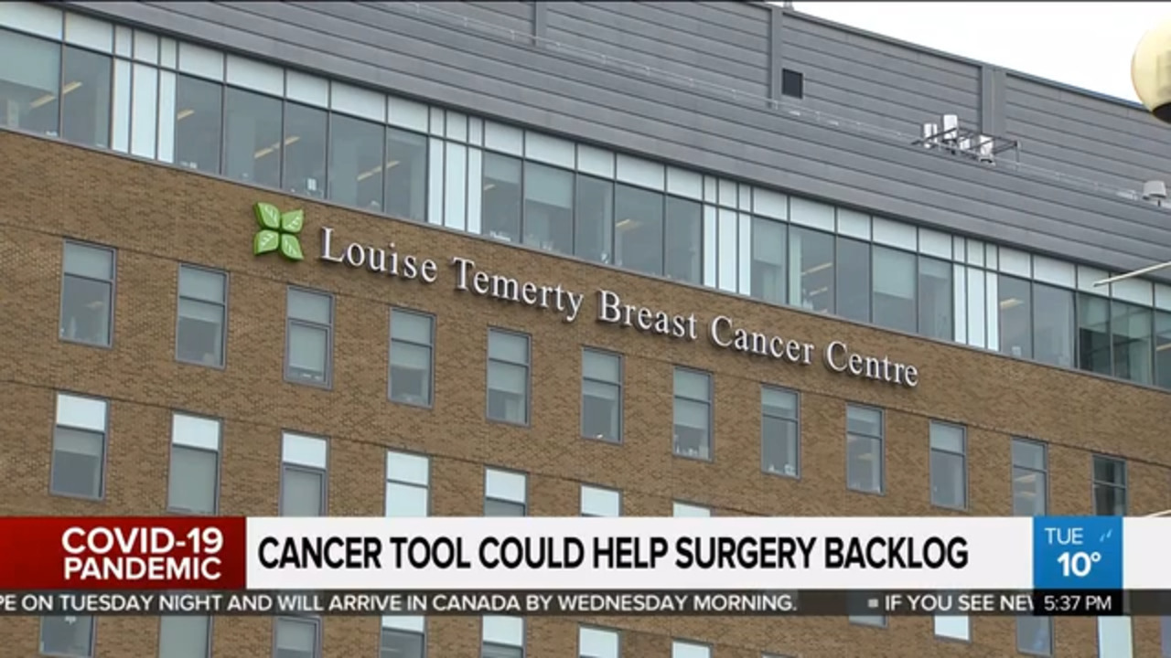 Cancer tool could help surgery backlog