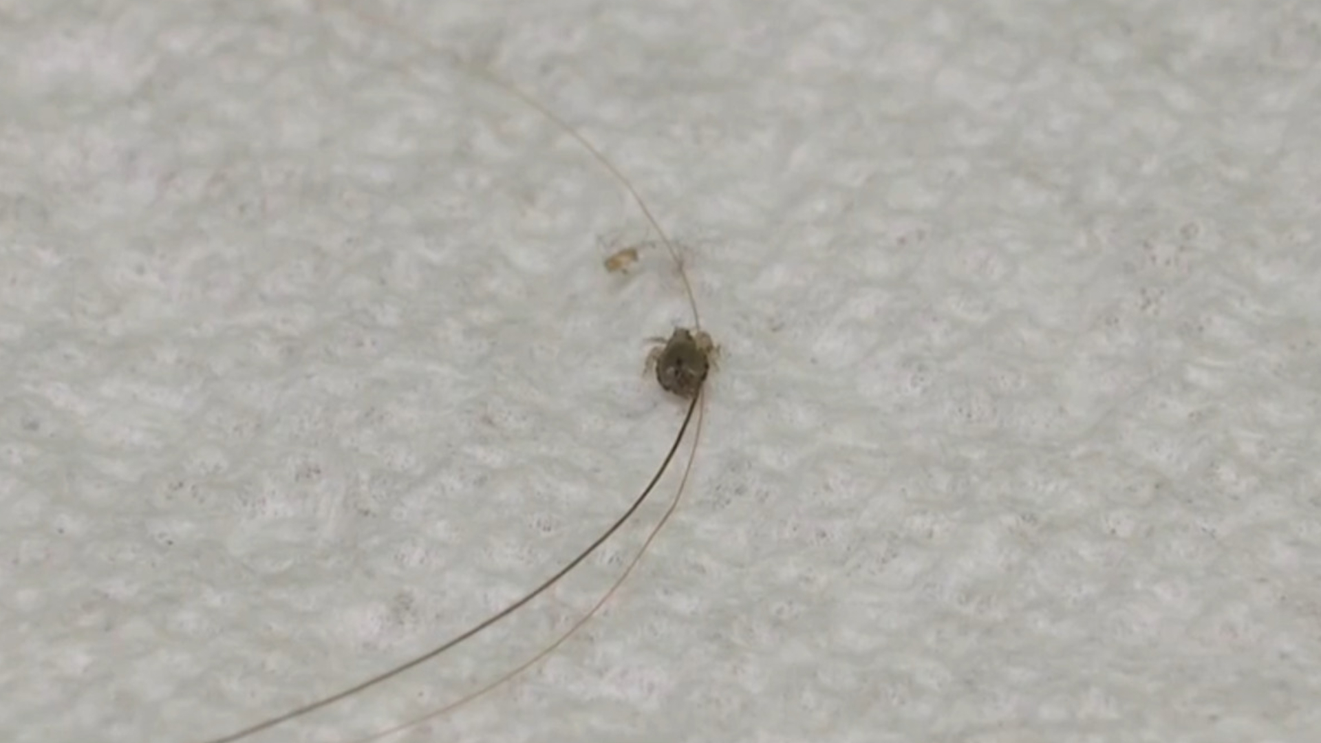 Experts warning about the rise of super lice