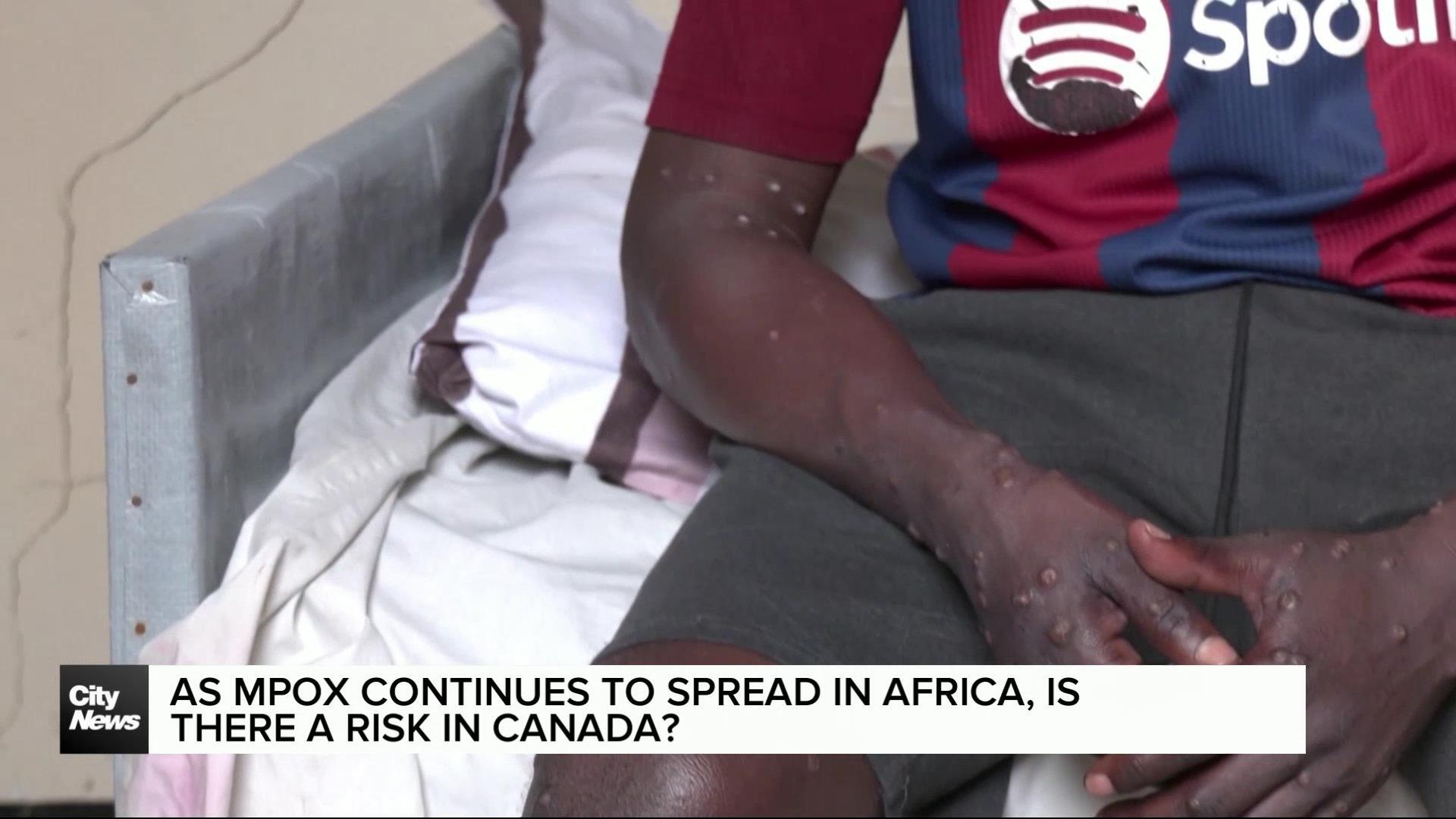 Does mpox pose a risk in Canada?