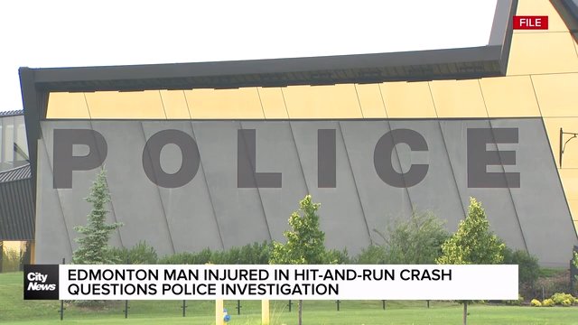 Edmonton man injured in hit-and-run questions police investigation