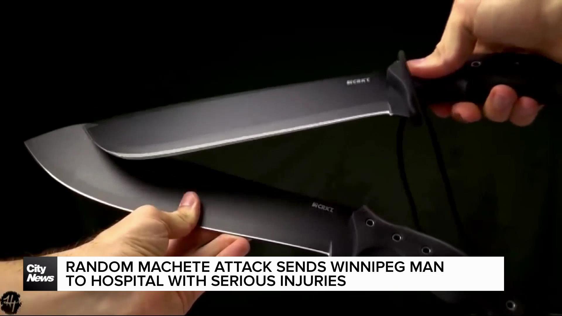 Winnipeg man in hospital after random machete attack