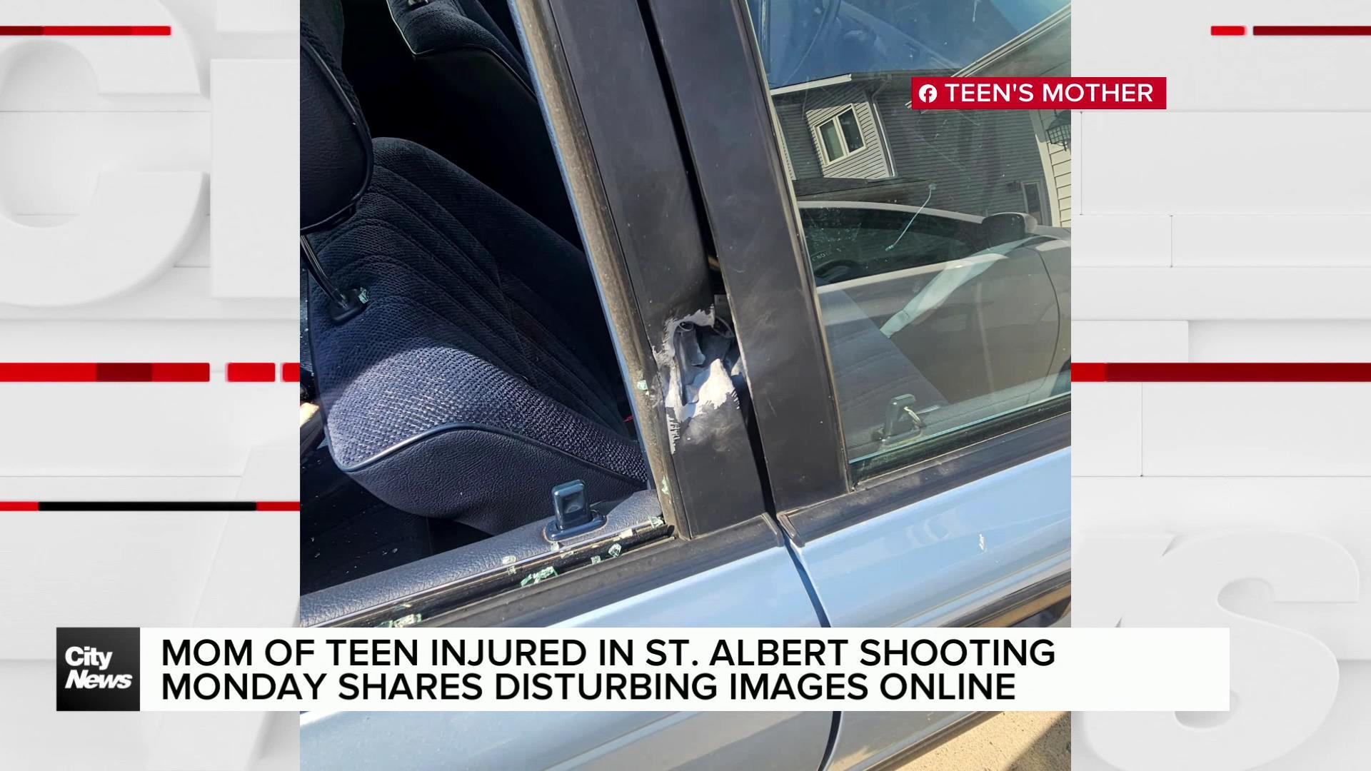 Mom shares horrific images after teen injured in St. Albert shooting Monday