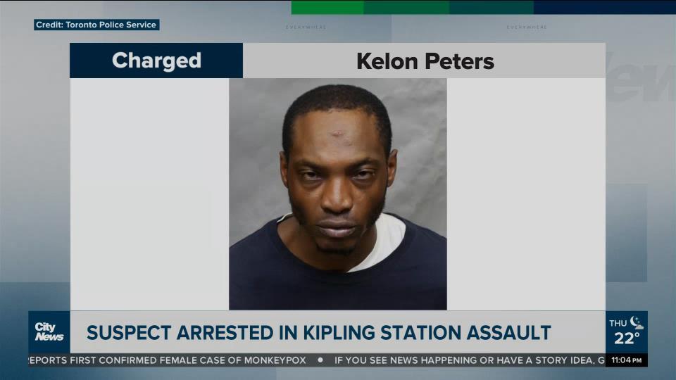 Man arrested in assault of elderly woman at Kipling station CityNews