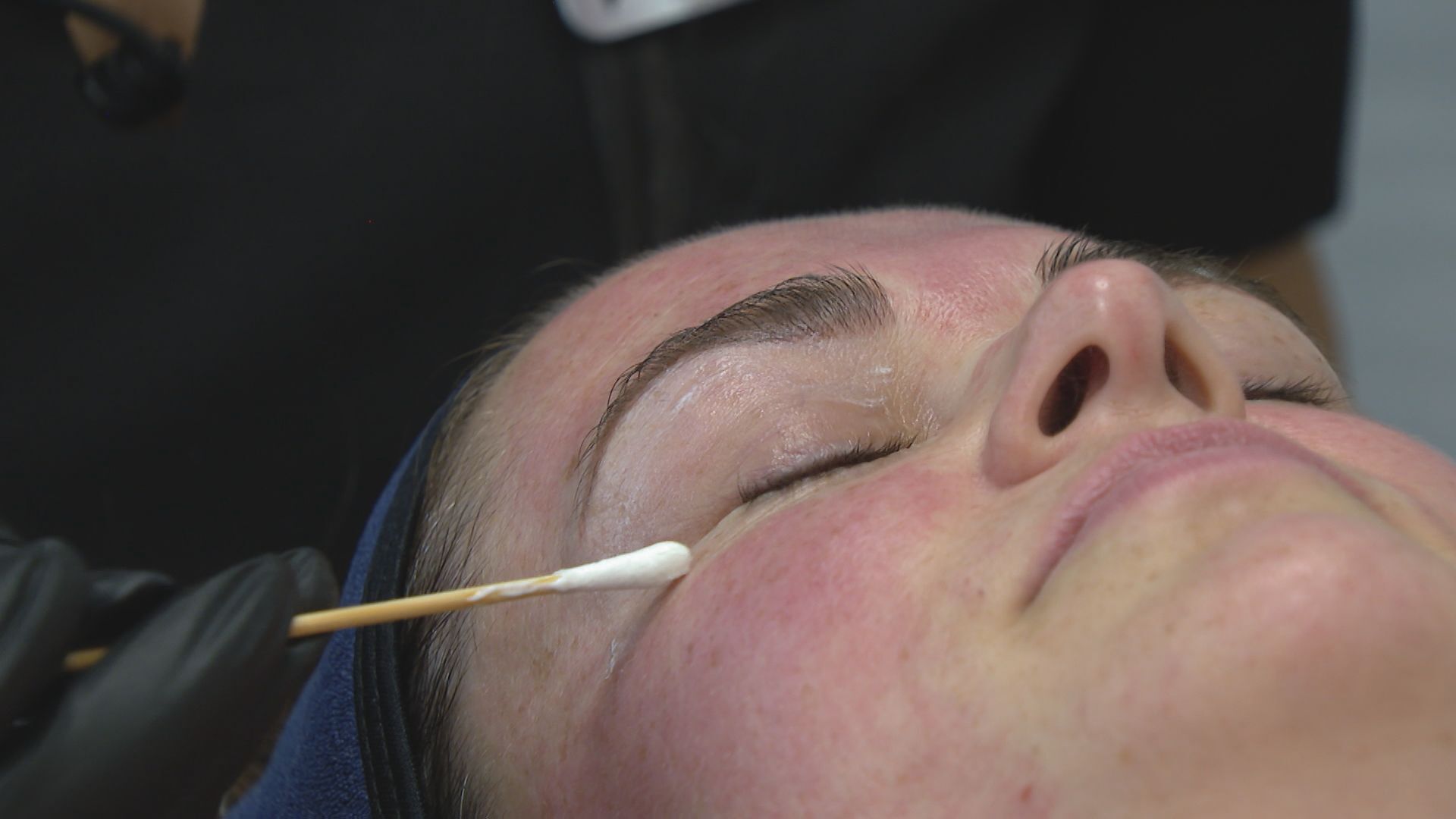 Ontario facing dermatologist shortage