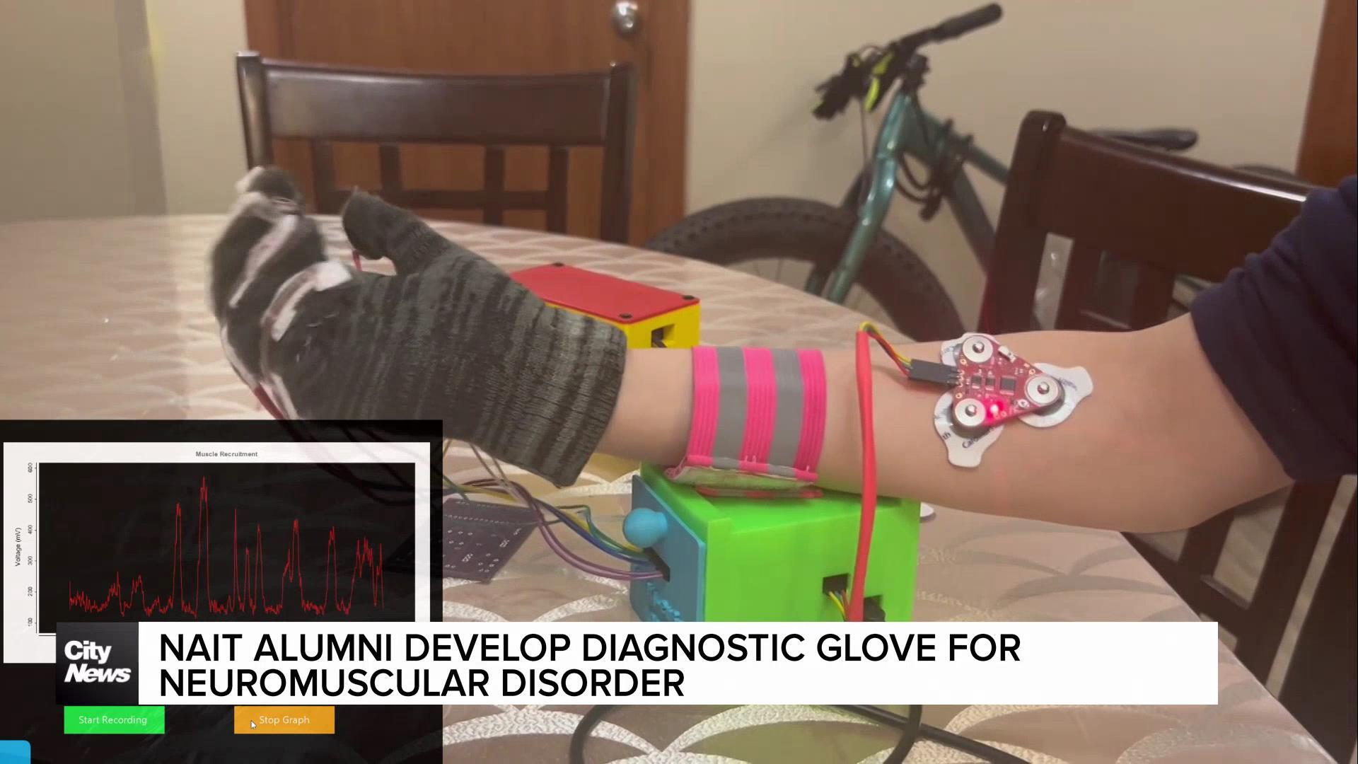 NAIT Alumni develop diagnostic glove for neuromuscular disorder