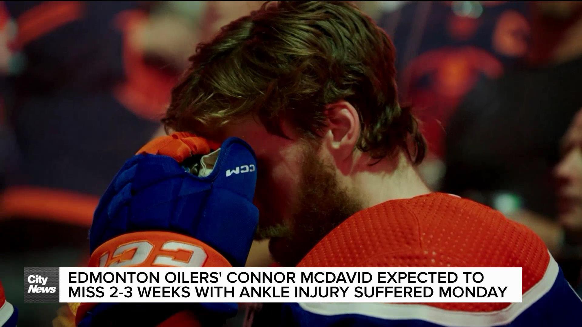 Oilers' Connor McDavid's injury sparks reaction from fans