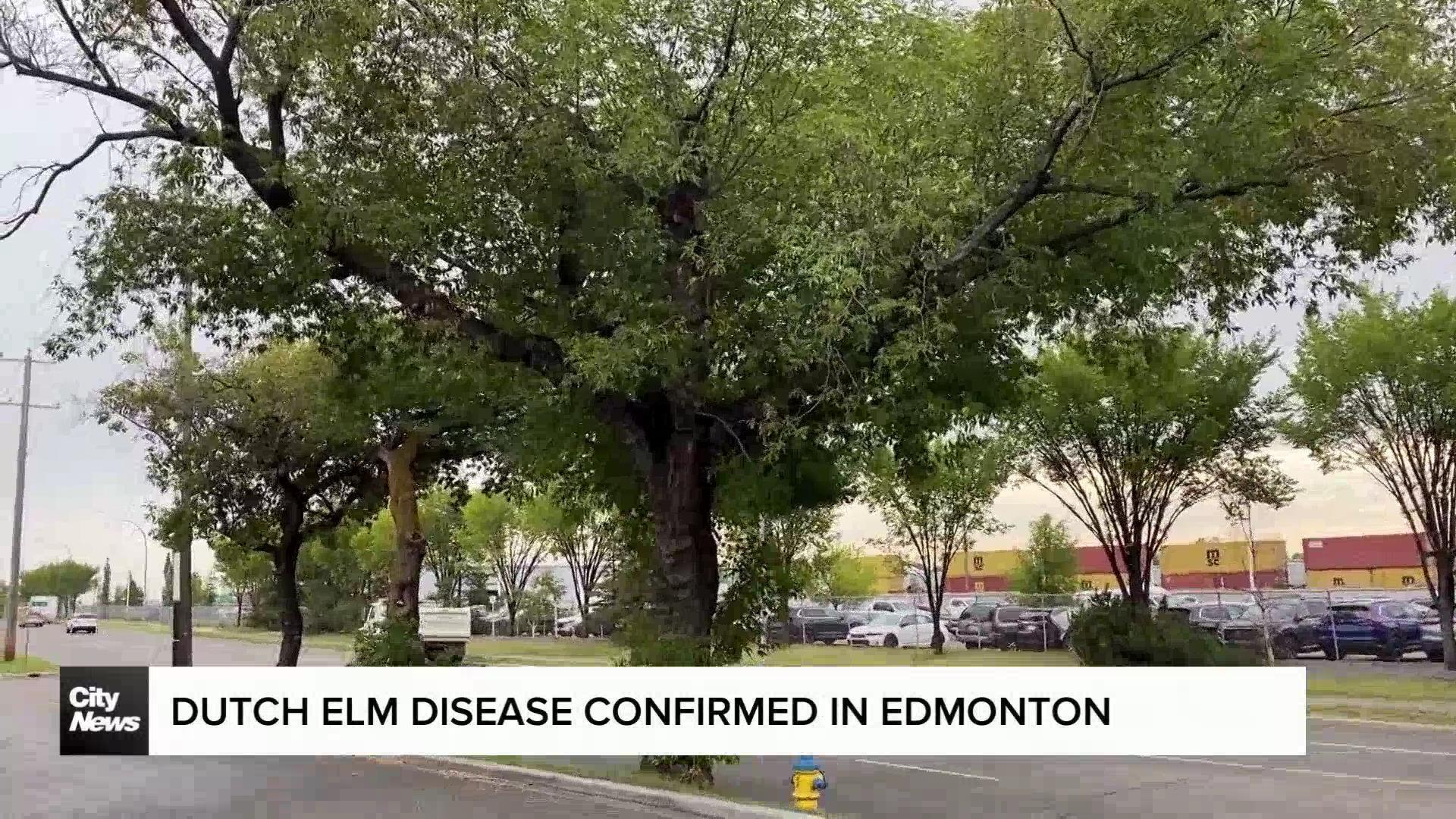 Dutch elm disease confirmed in Edmonton