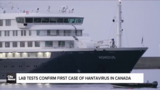 Lab tests confirm first case of hantavirus in Canada