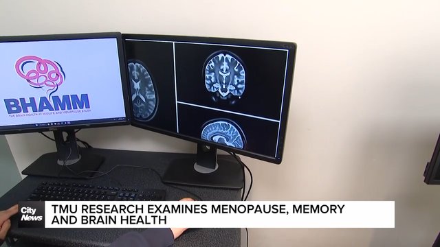 TMU research examines menopause, memory and brain health