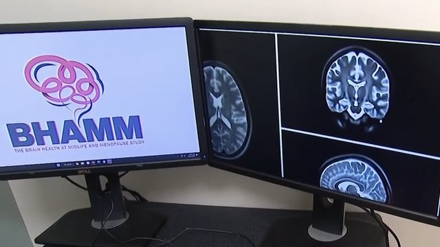 TMU research examines menopause, memory and brain health