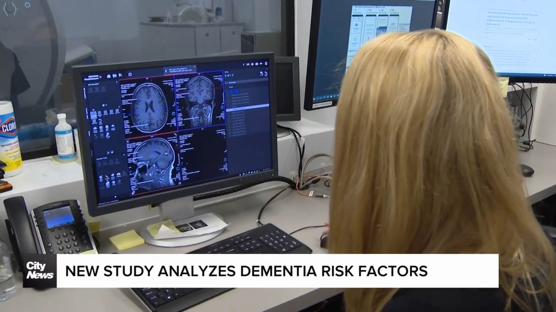 Dementia risk factors identified in new study