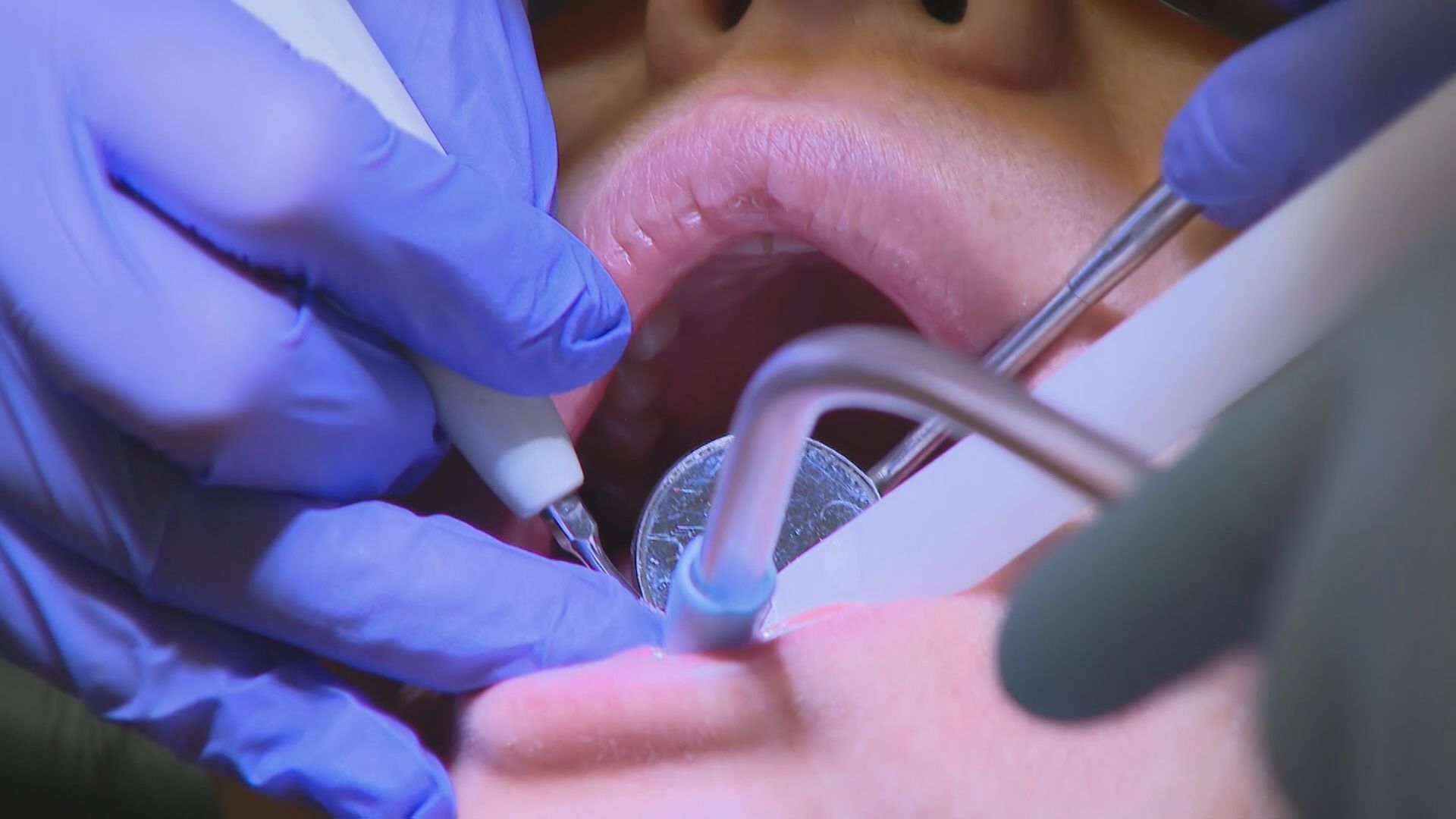 Dentists hesitant about federal dental plan