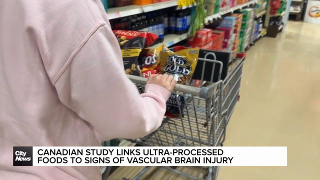 Canadian study links ultra-processed foods to brain injury