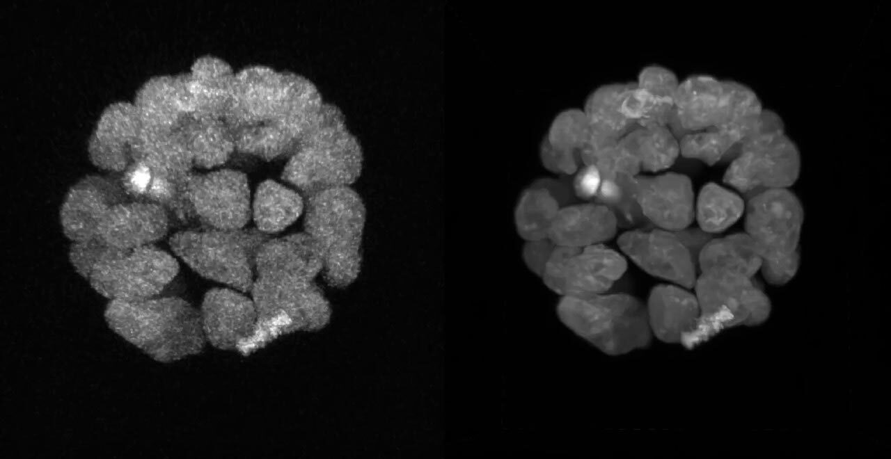 Denoise.ai | A1 HD25 / A1R HD25 | Confocal and Multiphoton