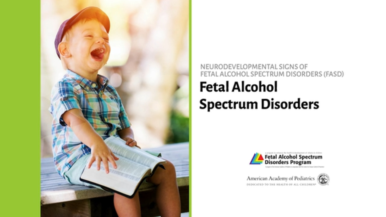 palpebral fissure fetal alcohol syndrome