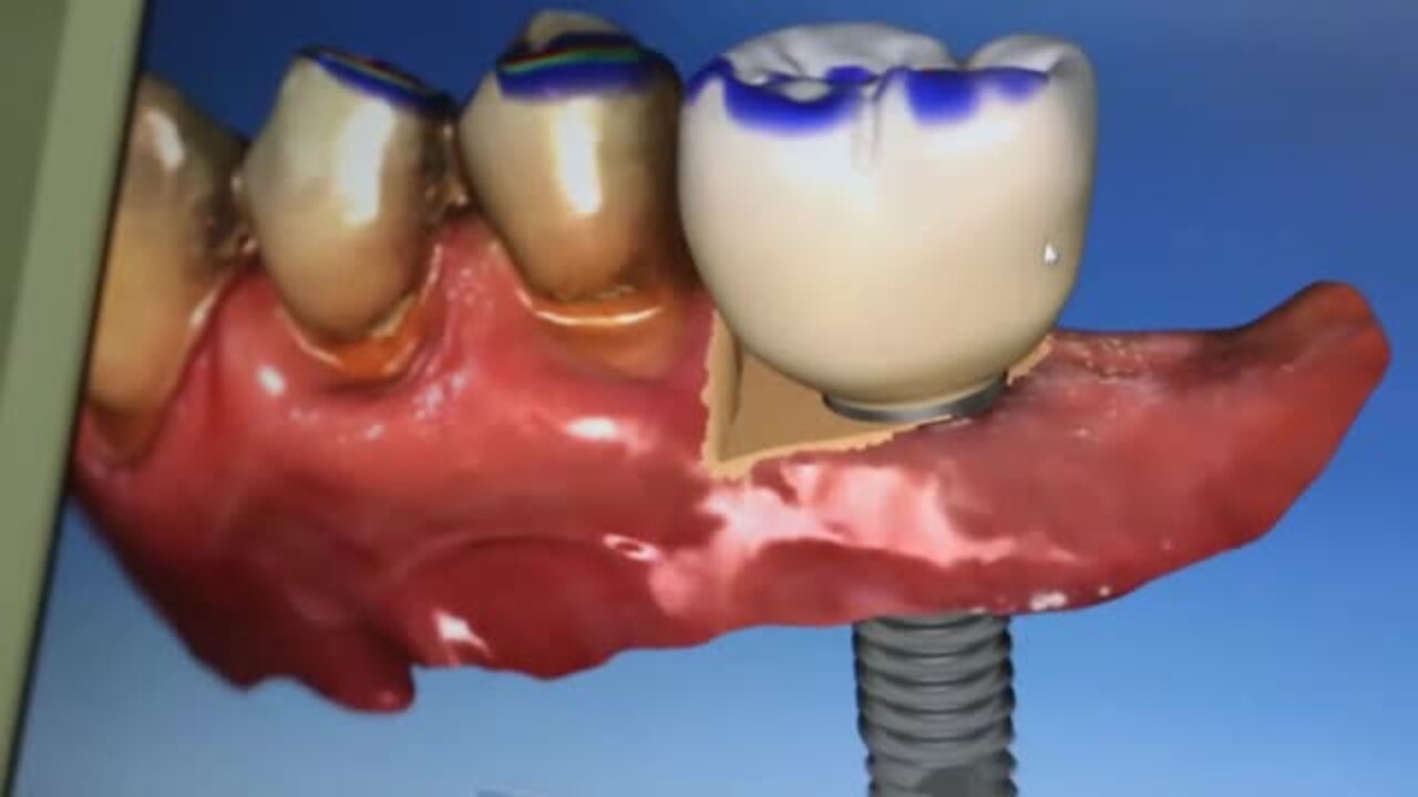 LAGUNA DENTAL Updated September 2024 66 Photos & 11 Reviews 28083