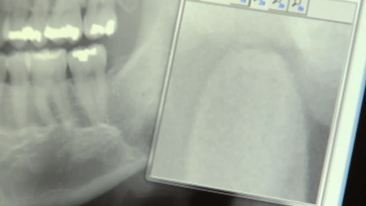 MINT KIDS DENTISTRY 31 Photos & 54 Reviews 1500 145th Pl SE