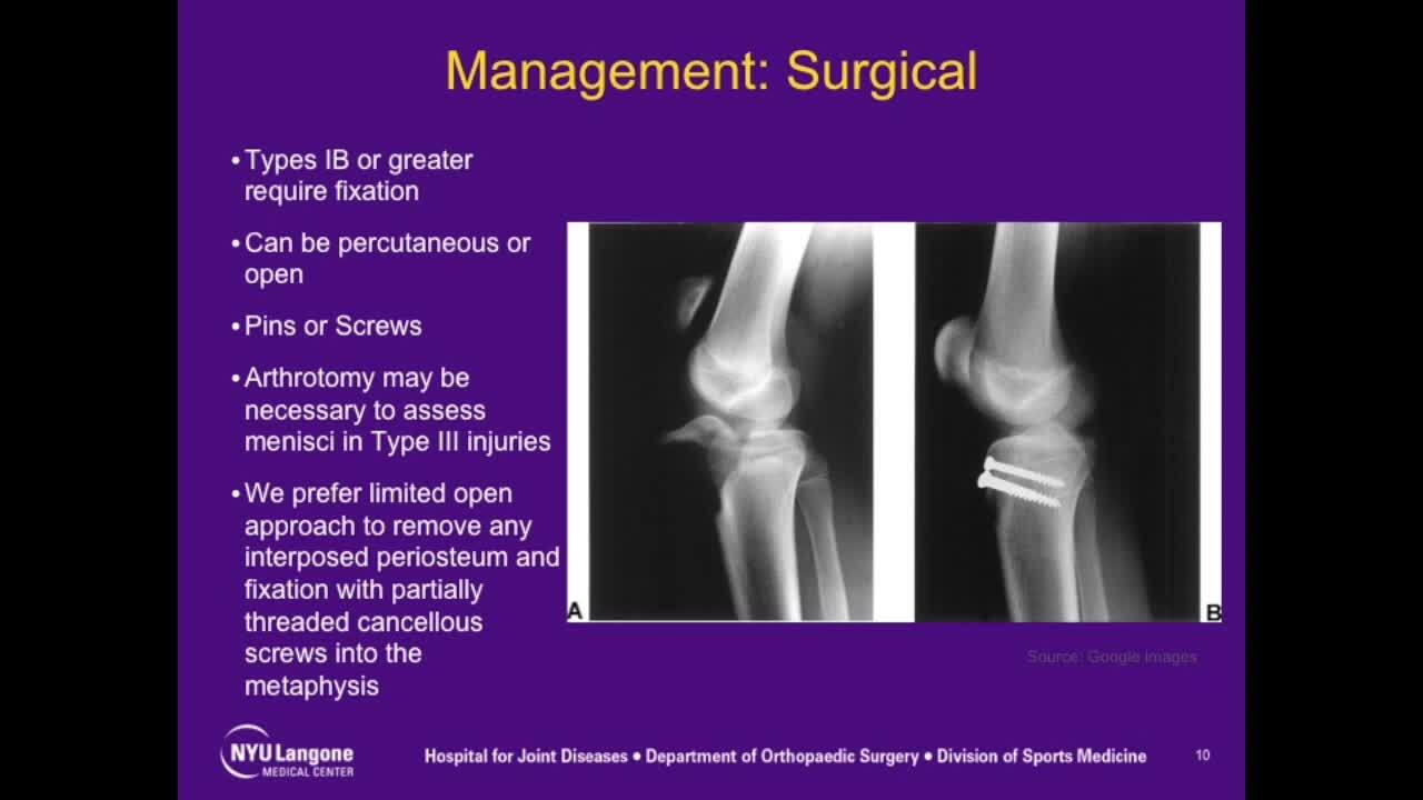 Tibial Tubercle Fracture 9983