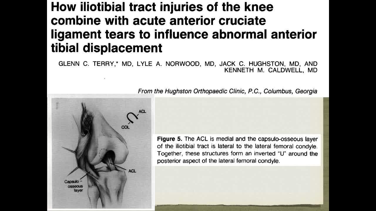 The Anterolateral Ligament Exists, Now What? Part 1 of 2 | VuMedi