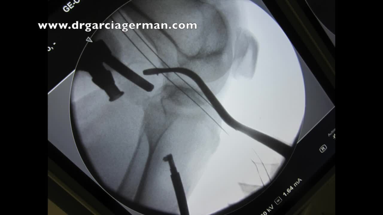 Nicolas Milazzo (@lic_nicolas_milazzo) • Instagram photos and videos, image size:1280x720