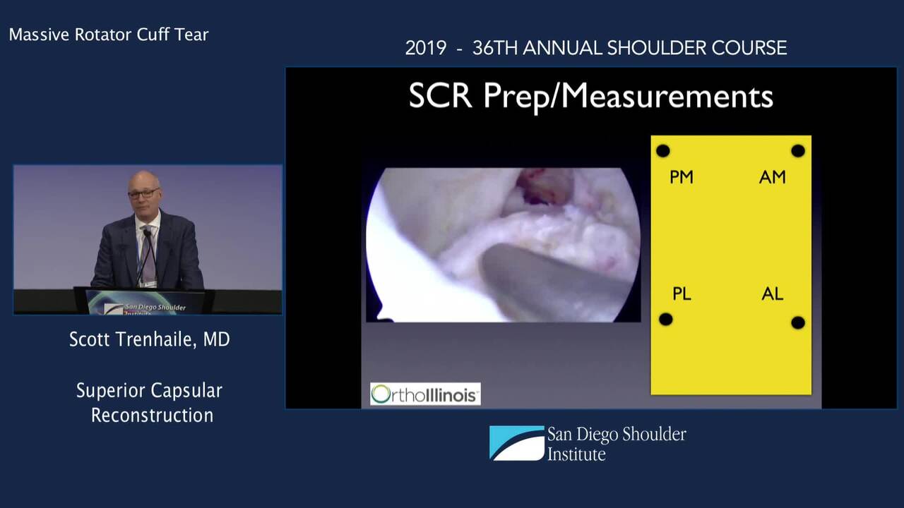 arthroscopic superior capsular reconstruction cpt code