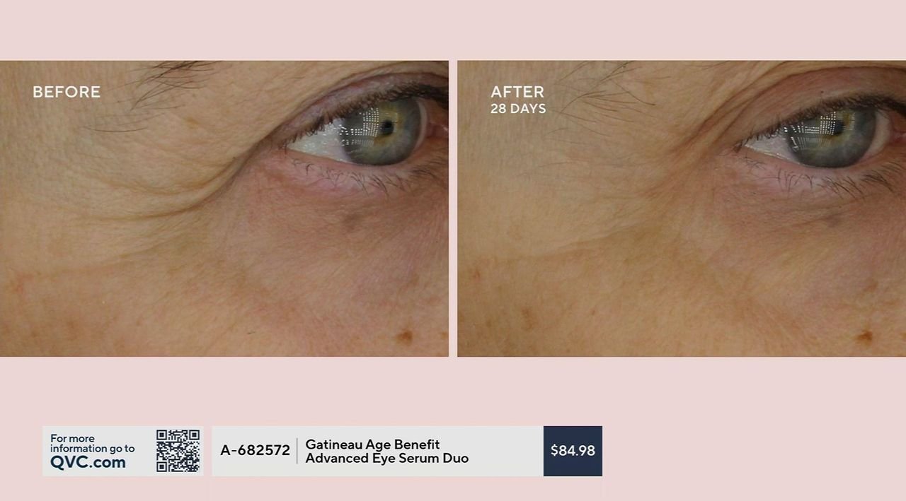 acyl-glutathione eyelid serum supersize duo Perricone MD Neuropeptide Lift 0.5oz FG Perricone MD Acyl-Glutathione Eye Lid