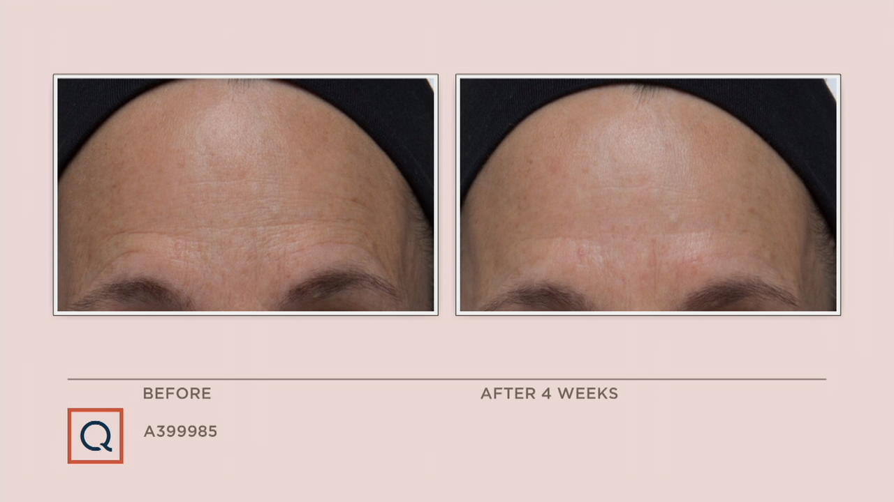 retinol it cosmetics