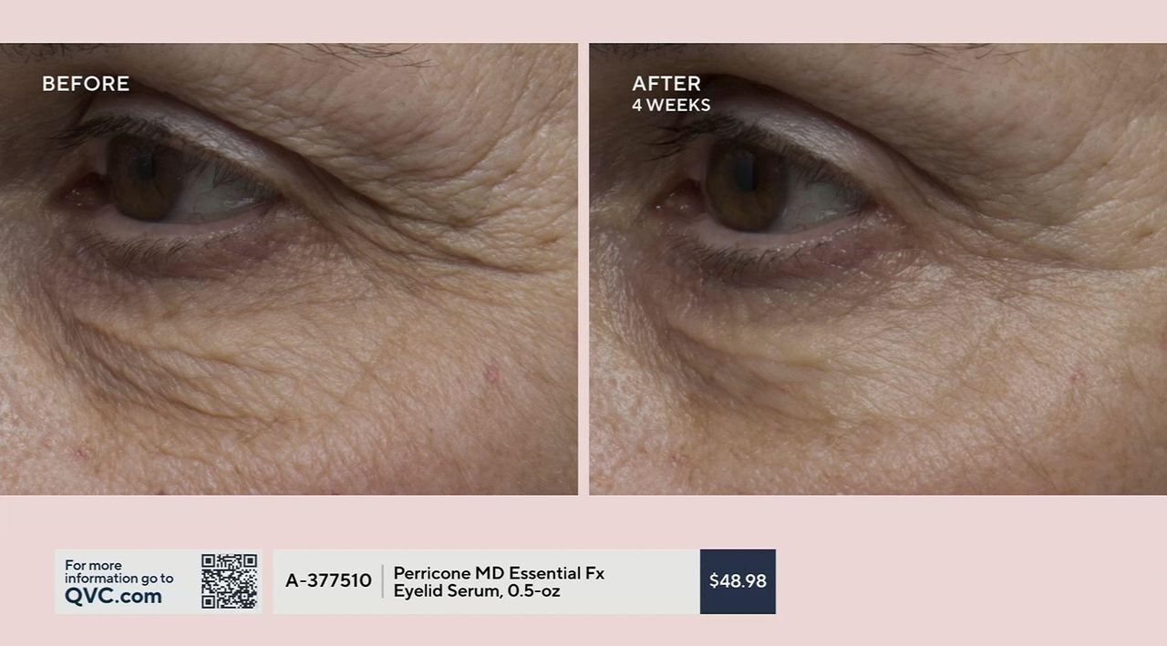 perricone md essential fx acyl glutathione eyelid lift serum details Essential Fx Acyl-Glutathione Eyelid Lift Serum main image 0