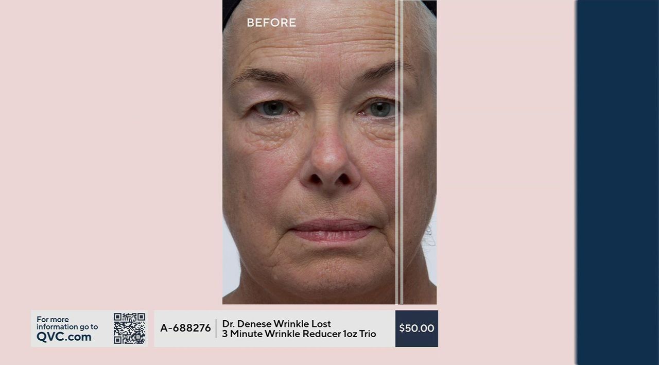 Dr. Denese Wrinkle Lost 3 Minute Wrinkle Reducer 1-oz Trio - QVC.com