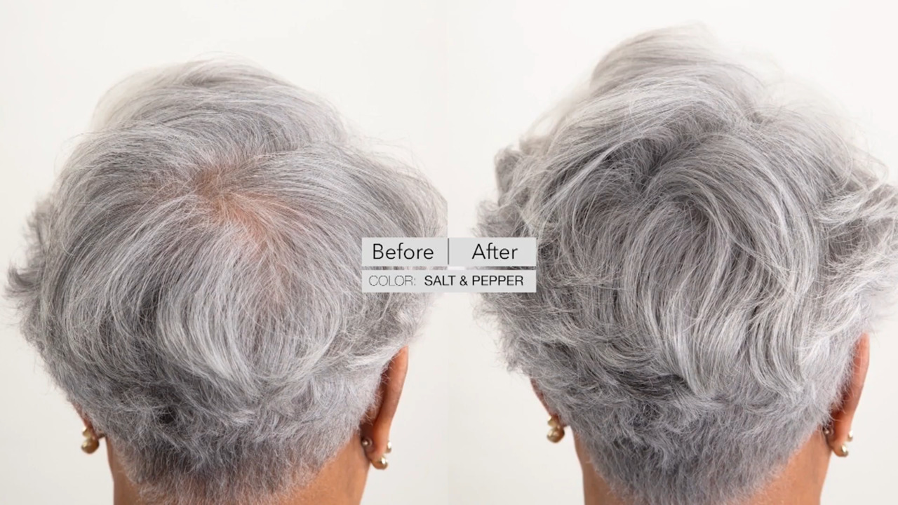 Before And After