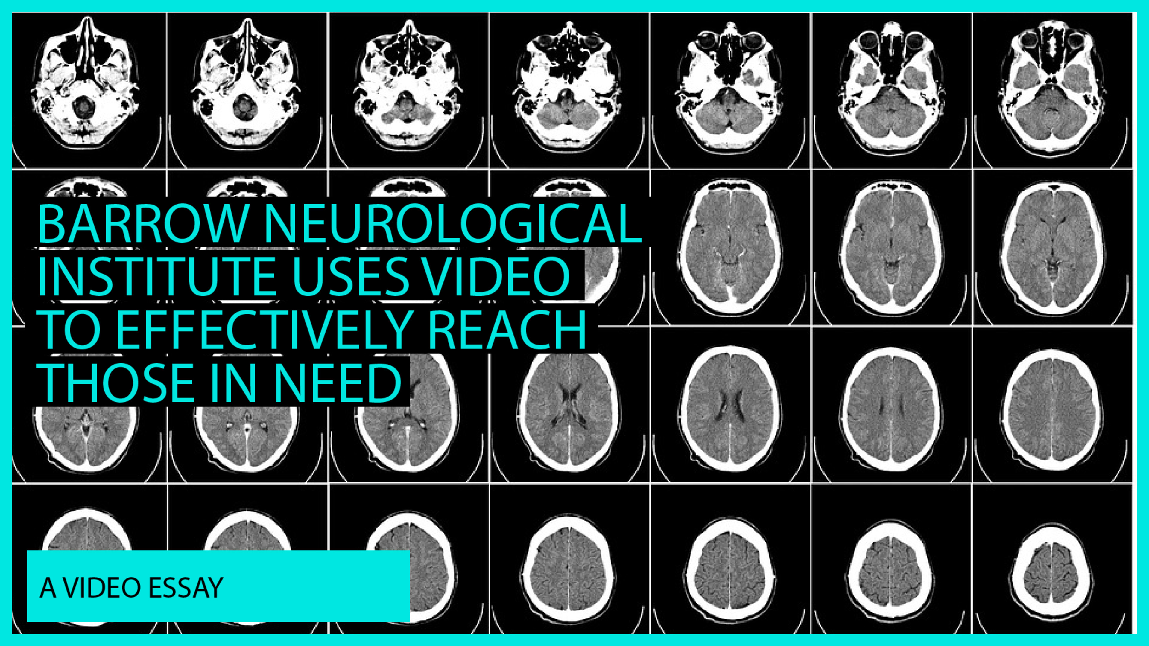 Barrow Neurological Institute Uses Video To Effectively Reach Those In Need