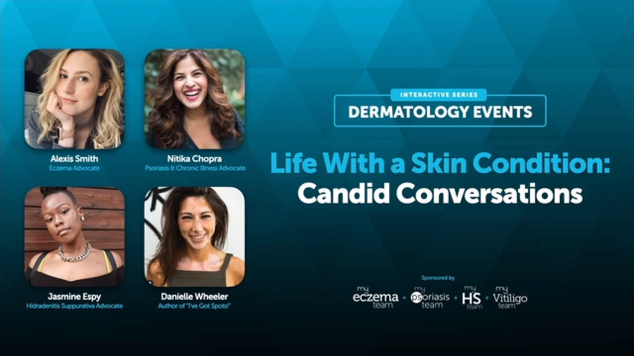 Watch on Demand: Life With a Skin Condition — Candid Conversations |  MyEczemaTeam