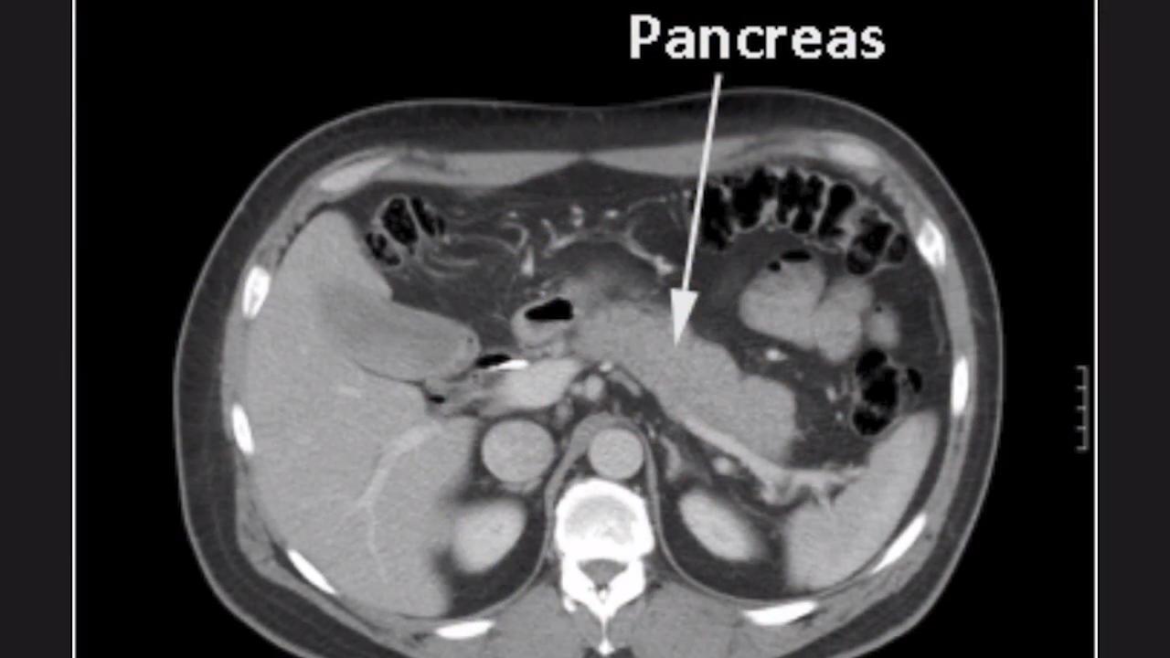 Normal Pancreas Size