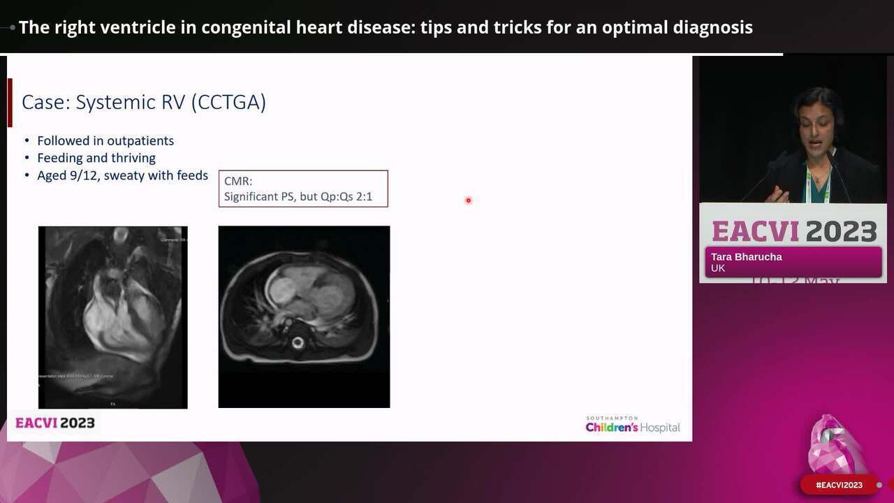 Right ventricle: multi-modal functional evaluation in specific settings