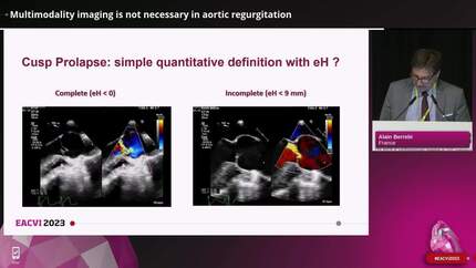 Aortic valve disease: make it simple or advanced?