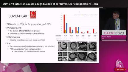 COVID-19 infection causes a high burden of cardiovascular complications
