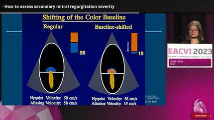 How to assess secondary valve disease