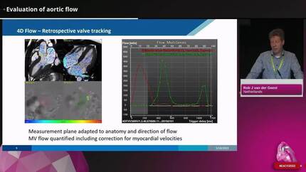 Current and future applications of 4D flow cardiovascular magnetic resonance