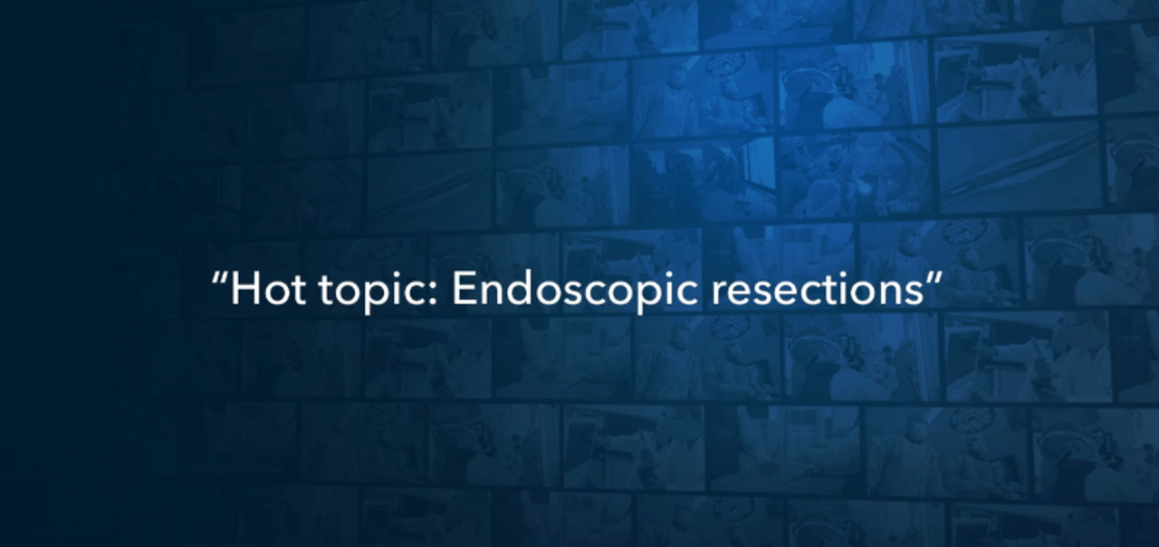 Hot topic: Endoscopic resections – Julie Yang, MD Video Thumbnail