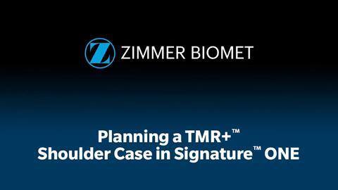 Signature™ ONE Surgical Planning