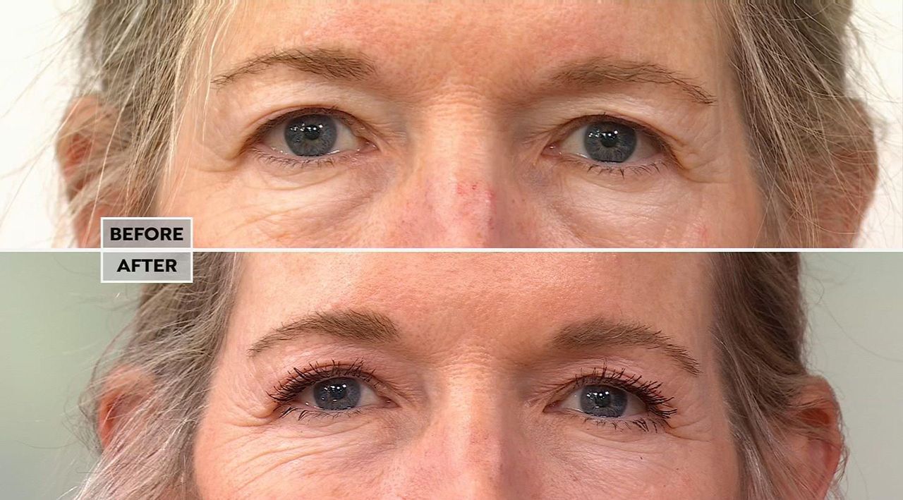 Nakery Beauty Lift-TOX 360 Firming Eye Lift Treatment Cream | HSN