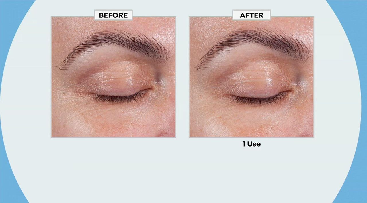 how to inject iv glutathione Benefits of Glutathione Injections Near Me in South Surrey, BC how to inject iv glutathione Benefits of Glutathione Injections Near Me in South Surrey, BC