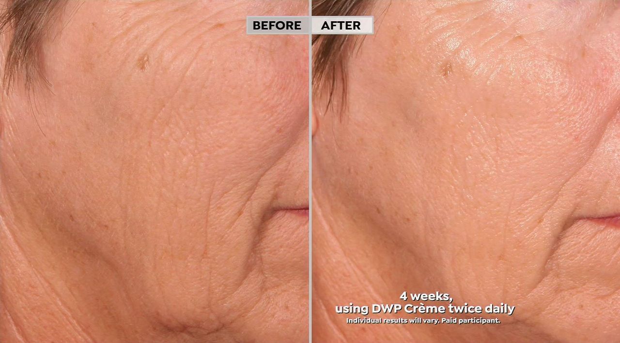 SKINN Supersize DWP Protocol Creme Reverse Intensive | HSN
