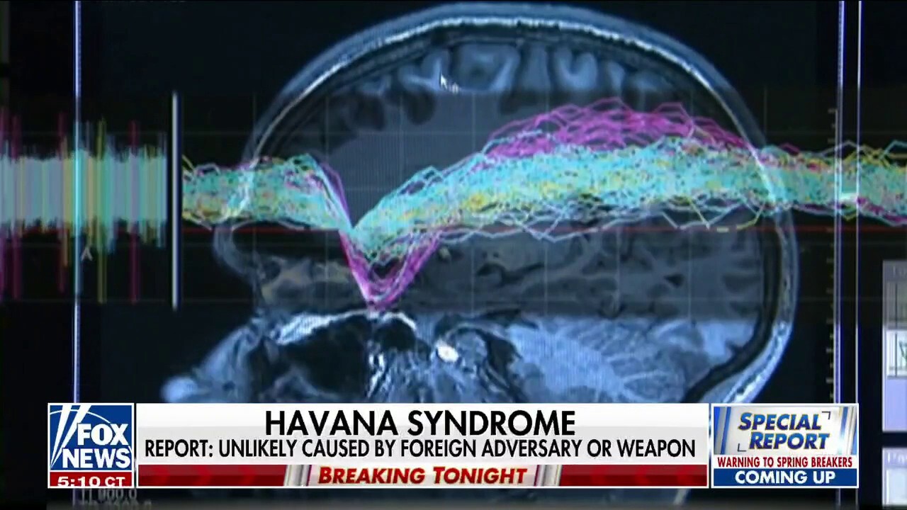 US intelligence says Havana syndrome is not caused by foreign rivals