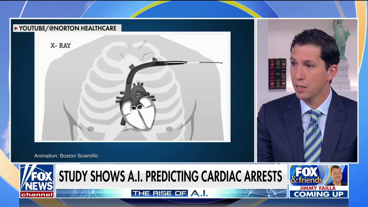 Study shows AI can predict heart attacks 