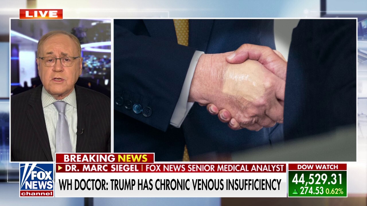 What President Donald Trump's chronic venous insuffiency means