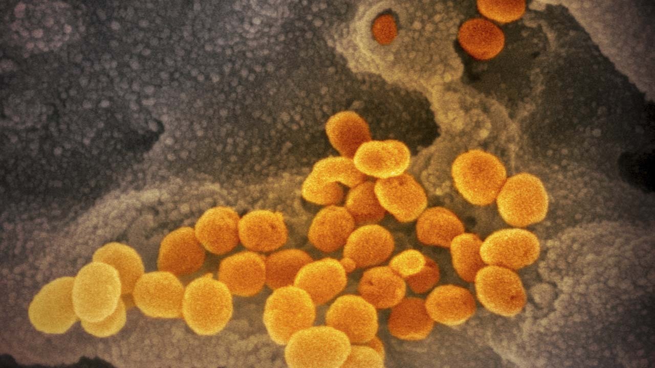 Disaster preparedness expert believes coronavirus outbreak is on verge of pandemic