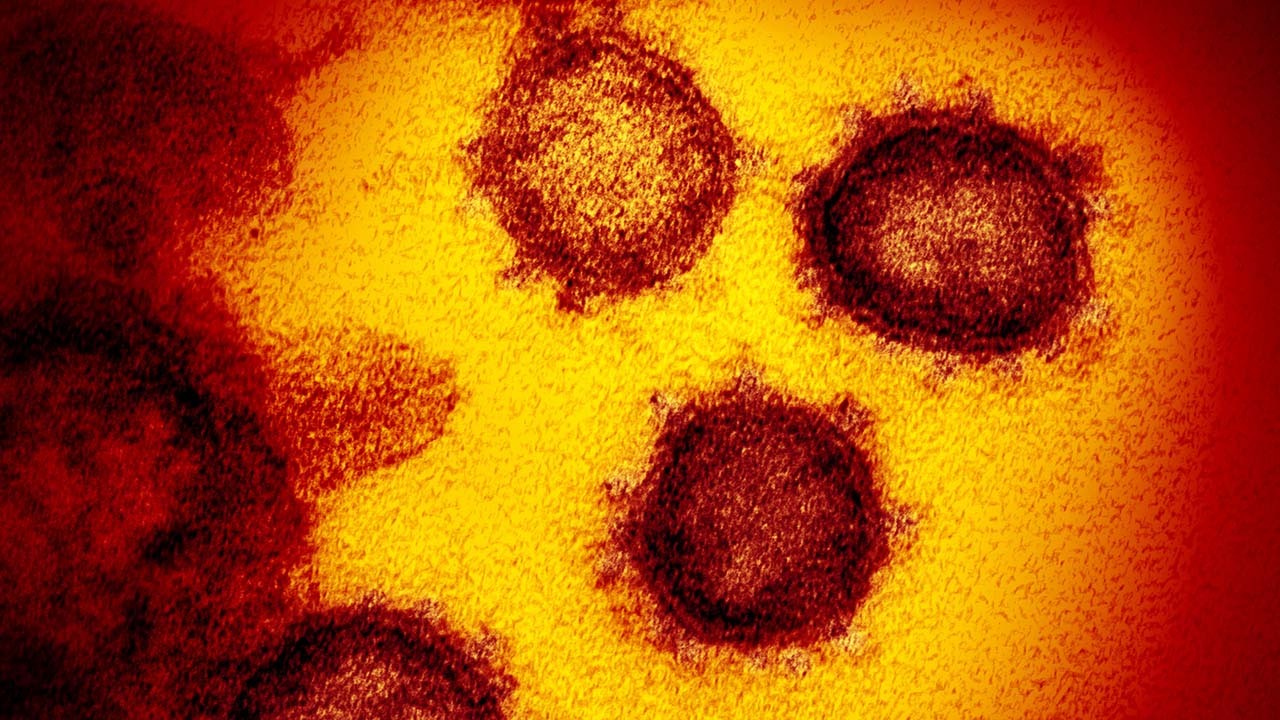 62 percent of Americans say they're worried about coronavirus