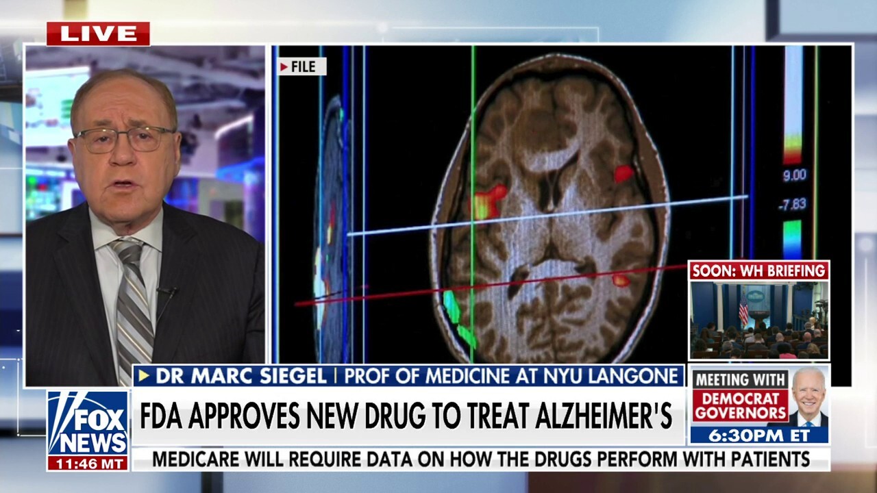 FDA approves new Alzheimer’s treatment option